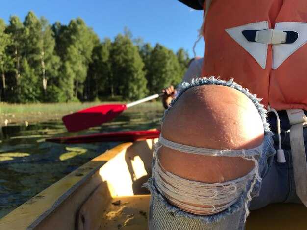 Types of Trolling Motors: Transom Mount vs Bow Mount