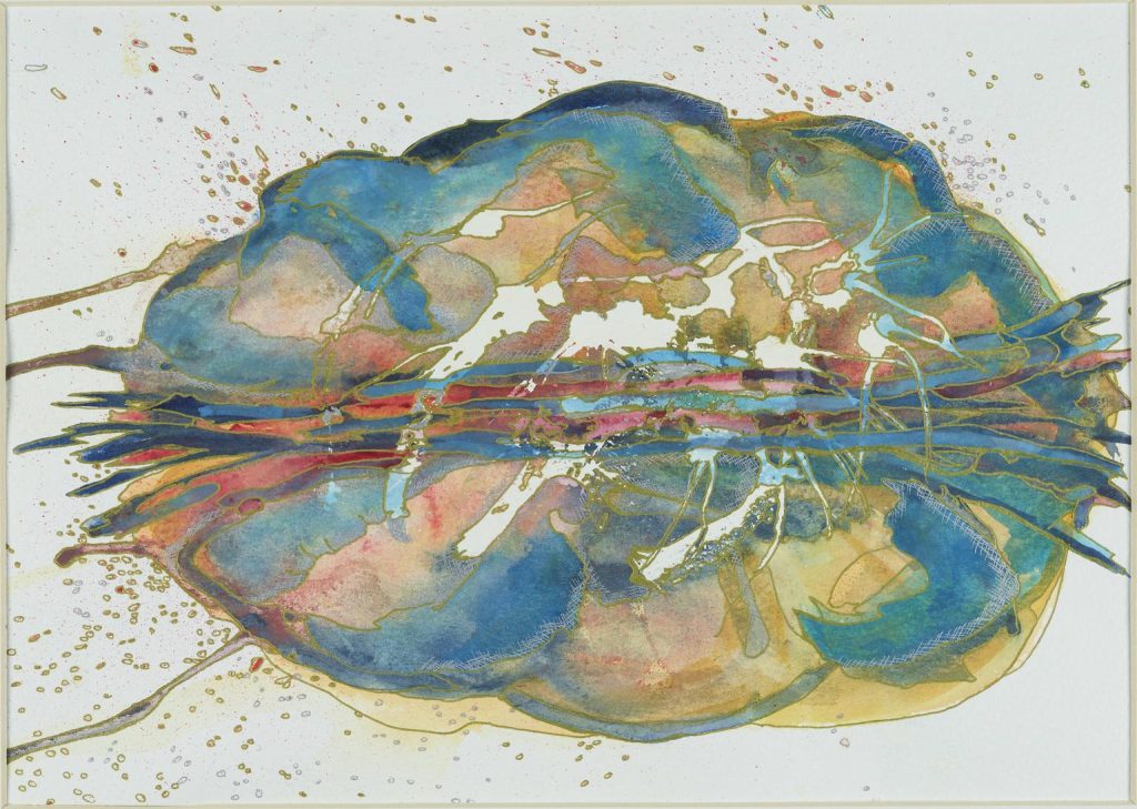 Understanding Stroke: Symptoms, Diagnosis, and Life-Saving Technology