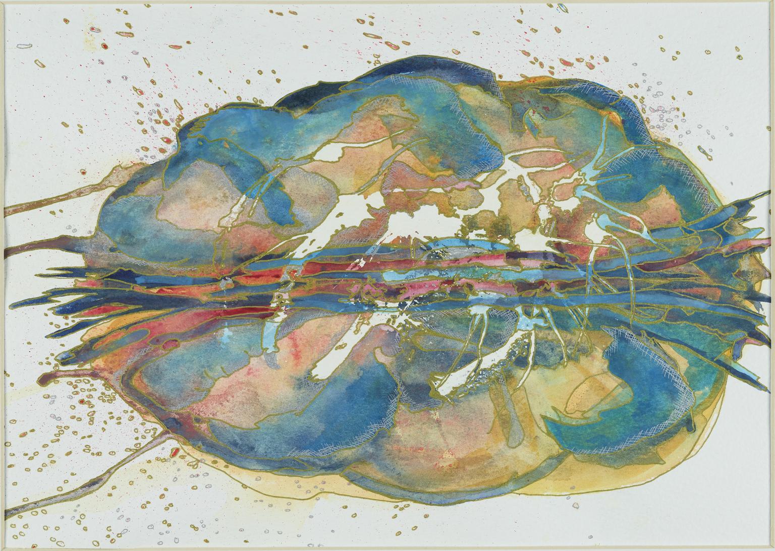 Understanding Stroke: Symptoms, Diagnosis, and Life-Saving Technology